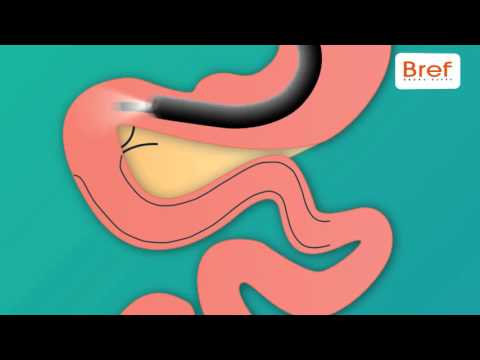Horuscare, lauréat des trophées Bref Rhône-Alpes de l'Innovation