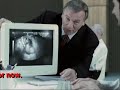 Friedreich\