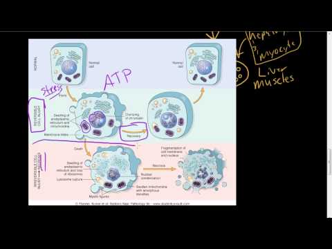 #7 – Overview of Reversible cell injury and necrosis: microscopic morphology