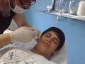 Alargando orelhas 0 a 10 mm ( scalp) - By Leão.