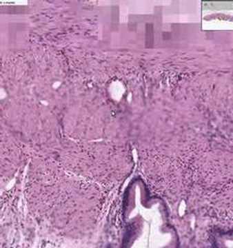Shotgun Histology Gall Bladder