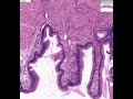 Shotgun Histology Gall Bladder