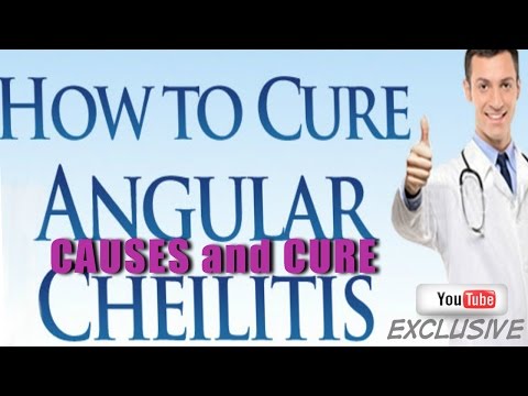 how to relieve embarrassment