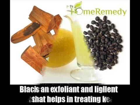 how to cure keloids naturally