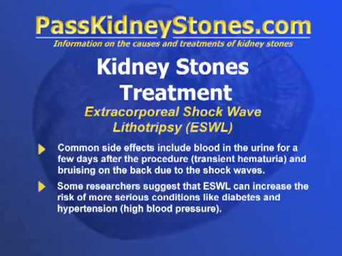how to get rid kidney stone pain