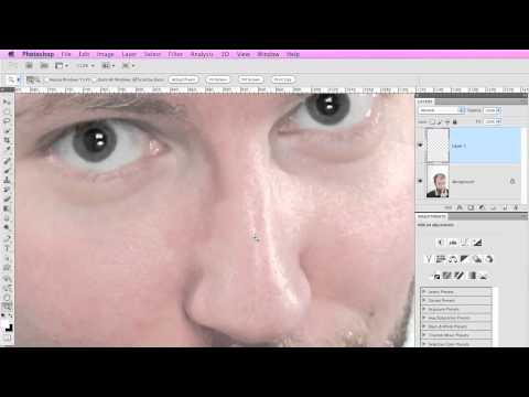 YouTube-forhåndsvisningsbillede