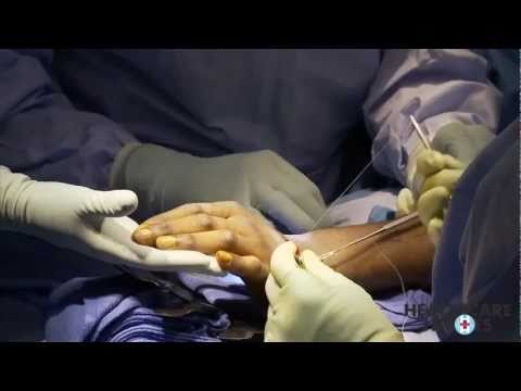 See video