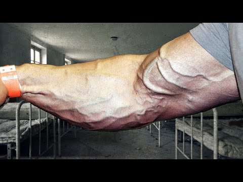 Перфорантные вены нижних конечностей