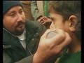 Médicos cubanos en el Himalaya - Parte 2