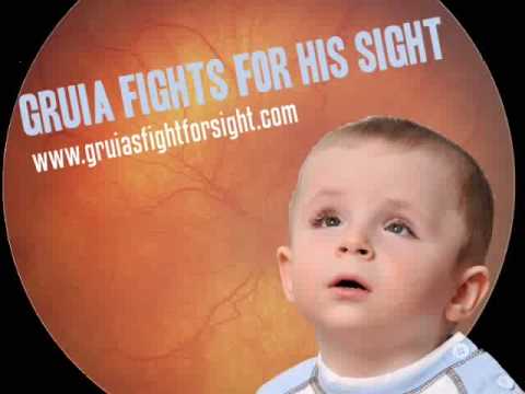 recurrent umbilical fungal infection umbilic