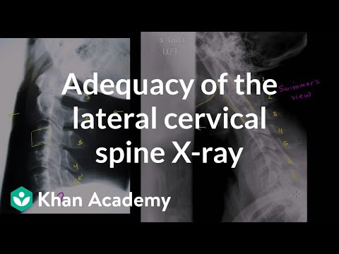 Healthcare and Medicine: Cervical Spine