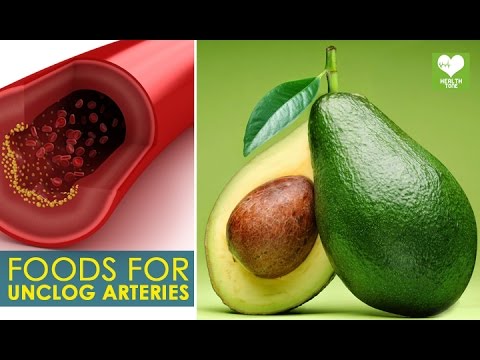 how to unclog arteries naturally