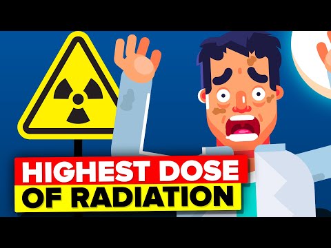 Man Receives Highest Dose of Nuclear Radiation - This Is What Happened To Him
