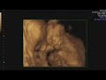 Baby Charlie's First Video