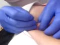 Ilsee krijgt dermal anchor piercing!
