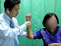 elbow impingement elbow pain ?????????