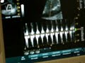 Baby McCoy Heartbeat Baby McCoy Heartbeat