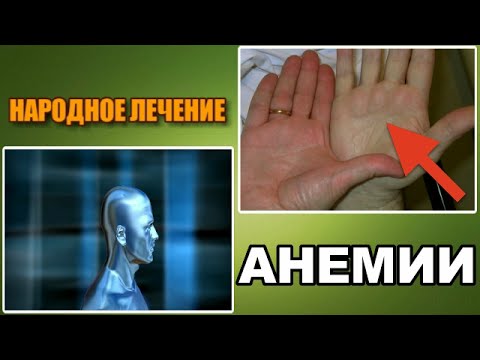 Как лечит анемию в домашних условиях Как лечит анемию в домашних условиях
