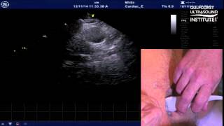 How to Obtain the Right Parasternal Window