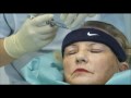 Sendung zum Thema Haartransplantation bei Frauen mit Dr. Frank Neidel
