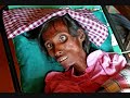 an-interview-regarding-the-origin-of-aids-pt-3.html