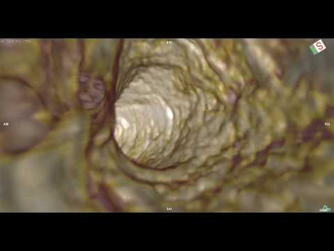 how to repair ct scan machine