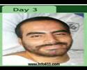 Cosmetic Facial Body Sculpting Newtown Huntingdon Valley