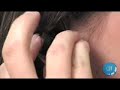BlueAnt Z9i Bluetooth Headset