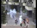 videos de Stun grenade causes serious injury to photojournalist