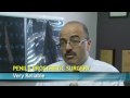 Erectile Dysfunction, Penile Prosthesis and Prostate Cancer