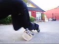 break foot XD me rompi la pata y wea break foot XD me rompi la pata y wea