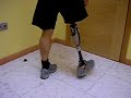 www.ortopediaaxis.com amputado femoral caminando www.ortopediaaxis.com amputado femoral caminando