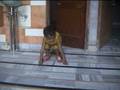 cerebral palsy