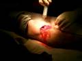 videos de Dirt bike accident cut  Part 2
