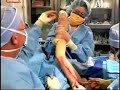 Iowa City Plastic Surgery Live: Arm Lift 4 of 14 Iowa City Plastic Surgery Live: Arm Lift 4 of 14