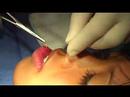 Part 3: NEEDLES!