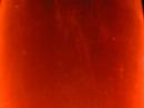 Anhedonia Anhedonia