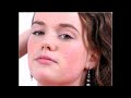 How to make skin perfect in GIMP