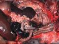 Medical School Pathology, Chapter 4d
