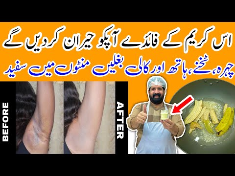 Earth Clinic - Natural Remedies for Better Health