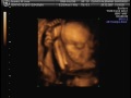 Ecografía 4D de nuestra hija Ecografía 4D de nuestra hija