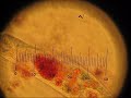 Cell Motility Cell Motility