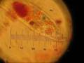 Cell Motility