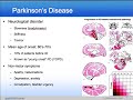 PatientsLikeMe Study: Young Onset Parkinson's Non-Motor Symp