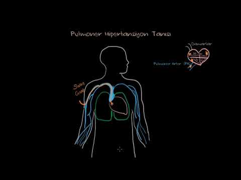 Khan Academy - Pulmoner Hipertansiyon Tanısı ve Swan-Ganz Kateterizasyonu (Fen Bilimleri) (Sağlık ve Tıp) - 2020.03.31