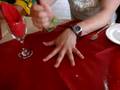 videos de Colin O Mahoney about to lose a finger