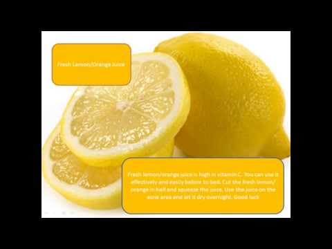 how to get rid of acne by home remedies