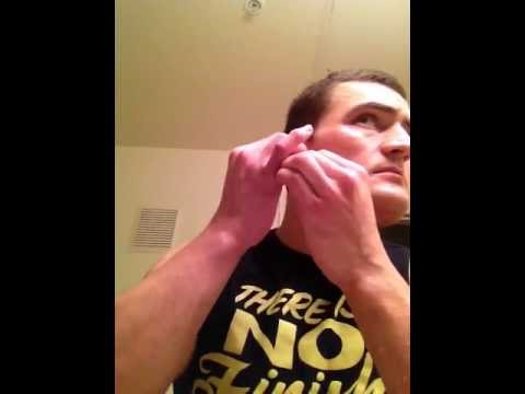 how to treat cauliflower ear