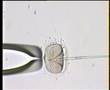 ICSI PROCEDURE