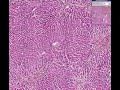 Histopathology Liver --Chronic passive congestion with hemor Histopathology Liver --Chronic passive congestion with hemor